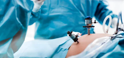 Endometriosis minimally invasive treatment - laparoscopic care by Dr. Prithivi Perum, Manikonda, Hyderabad