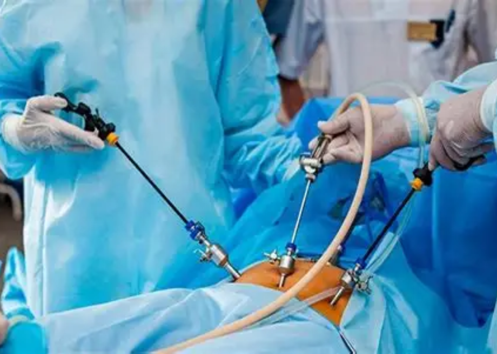 Minimally invasive laparoscopic gynecological surgery by Dr. Prithivi Perum, Hyderabad