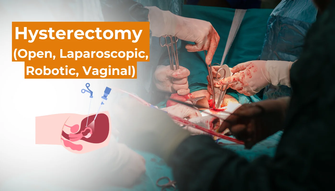 Hysterectomy - open, laparoscopic, robotic and vaginal surgery by Dr. Prithivi Perum, Manikonda, Hyderabad