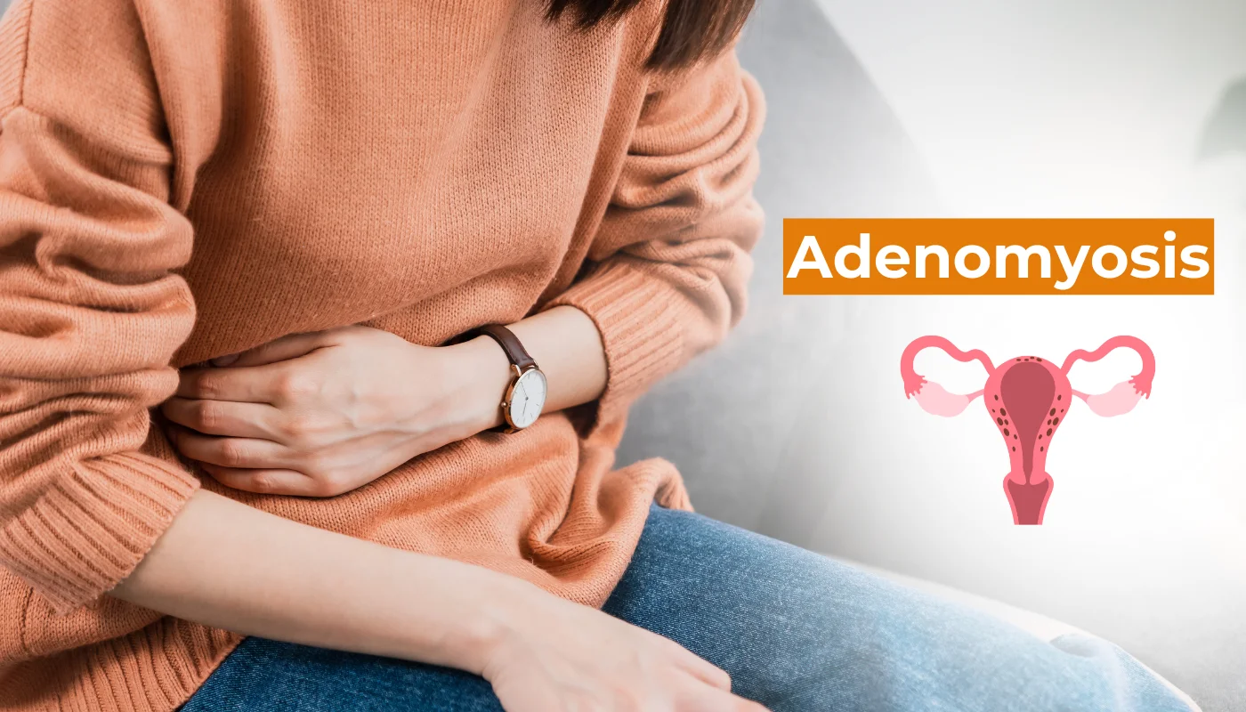 Adenomyosis treatment and pain management by Dr. Prithivi Perum, Manikonda, Hyderabad